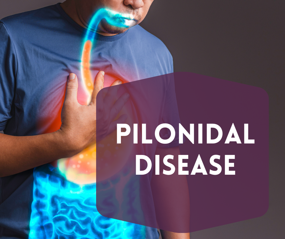 What Are Your Chances For Pilonidal Disease? Understand Your Body!